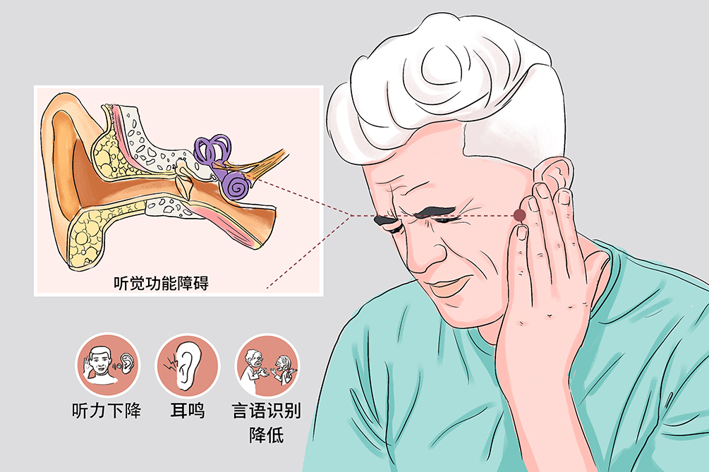 耳聋下降的特点是怎样的？(图1)